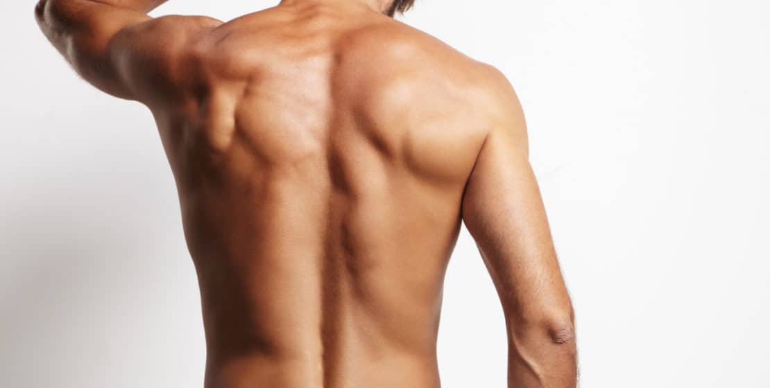Permanent hair removal