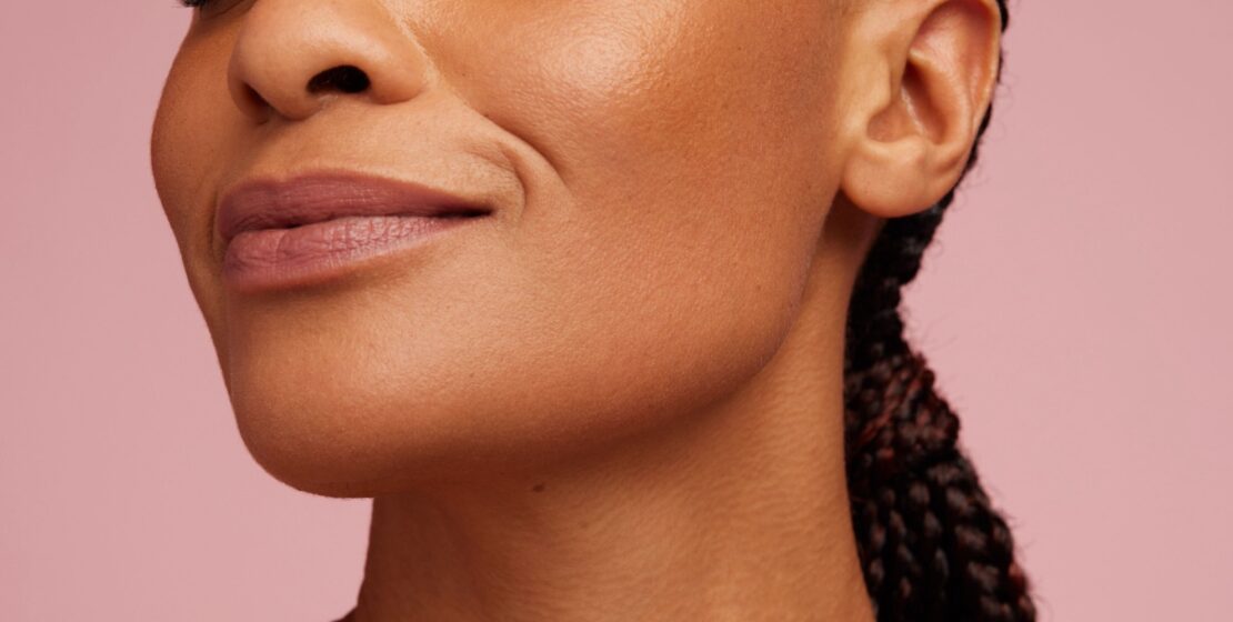 Radiofrequency with Endymed or Exilis