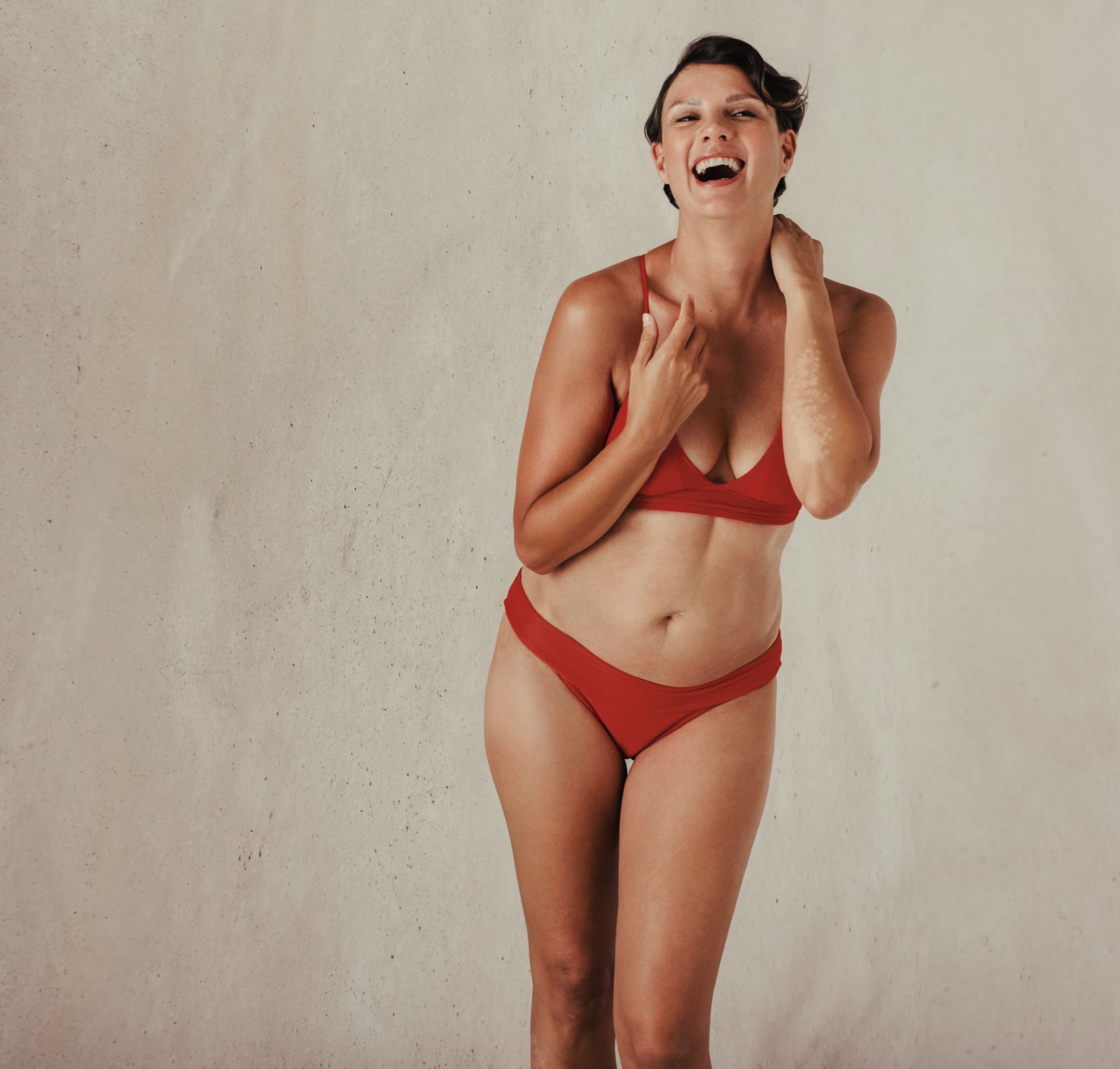 Profhilo® Body