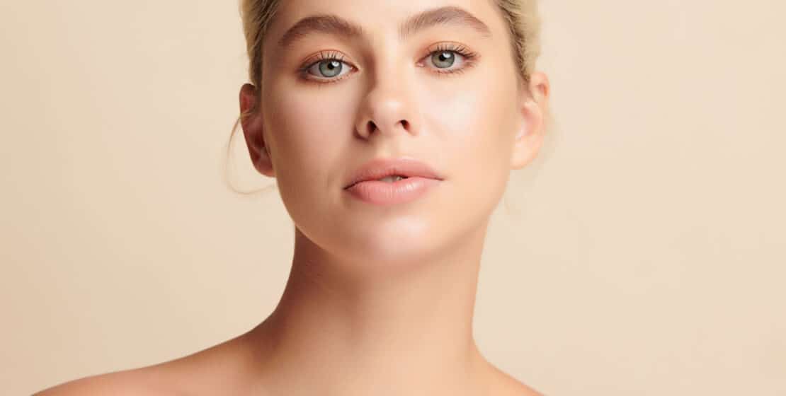 Fractional laser scarring and acne