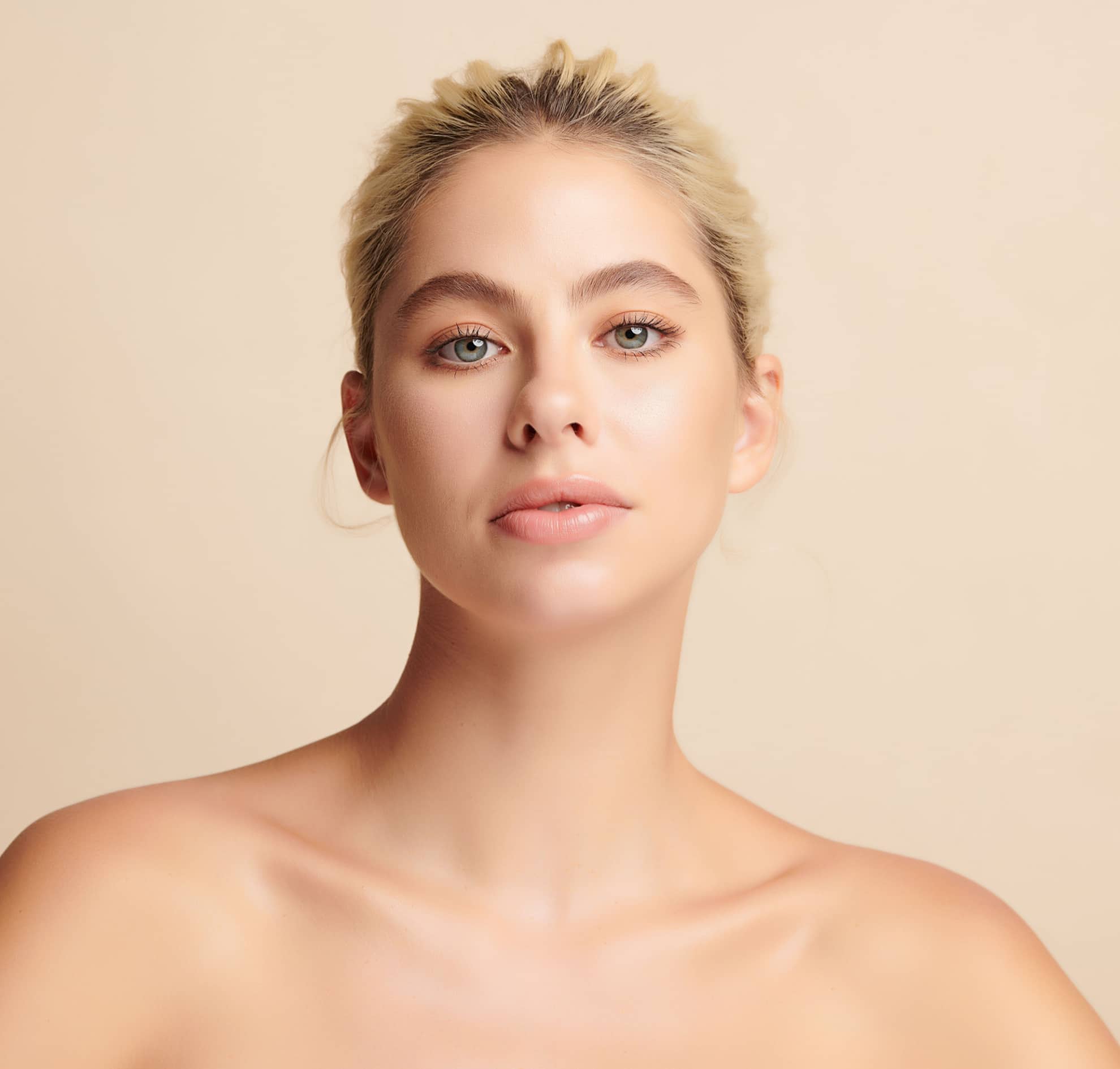 Fractional laser scarring and acne