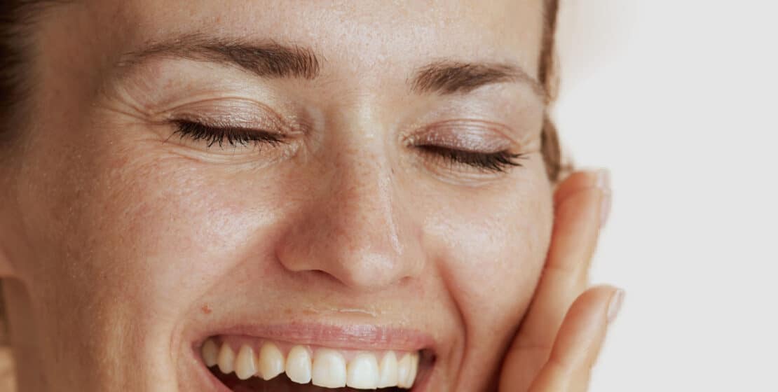 Smoothing fine lines with Fraxel
