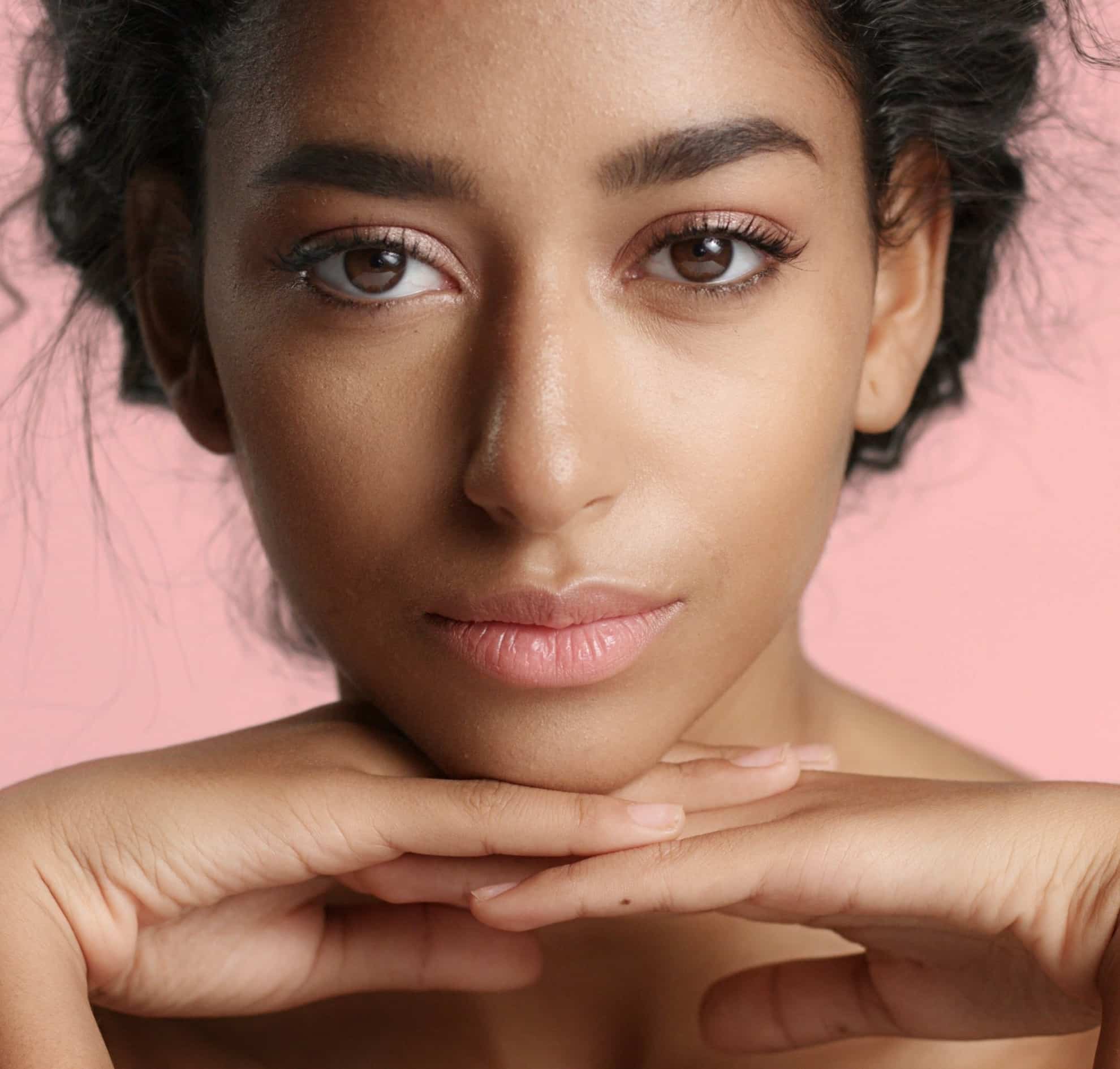 Microneedling