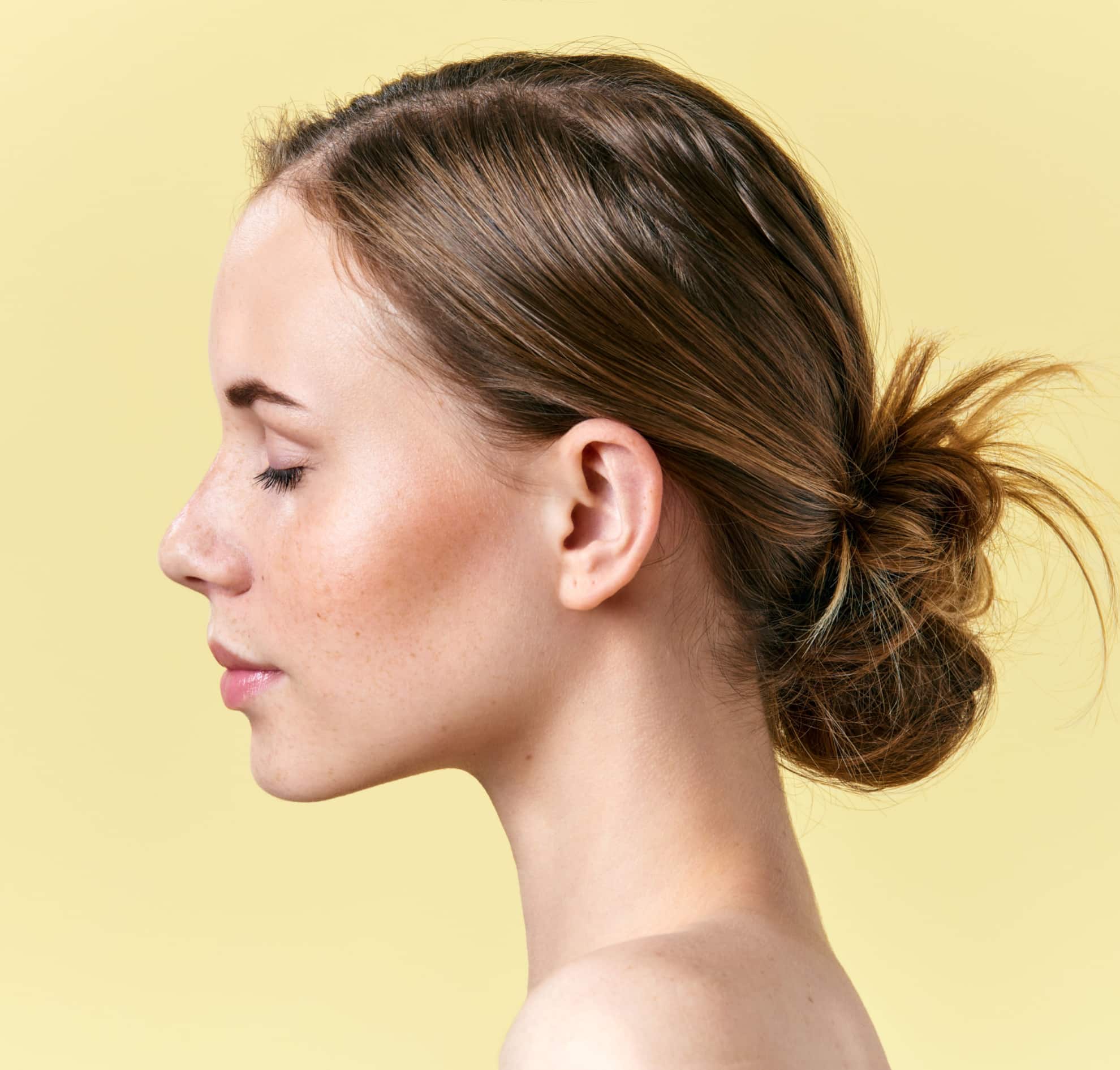 Nose reshaping