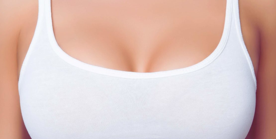 Breast Augmentation