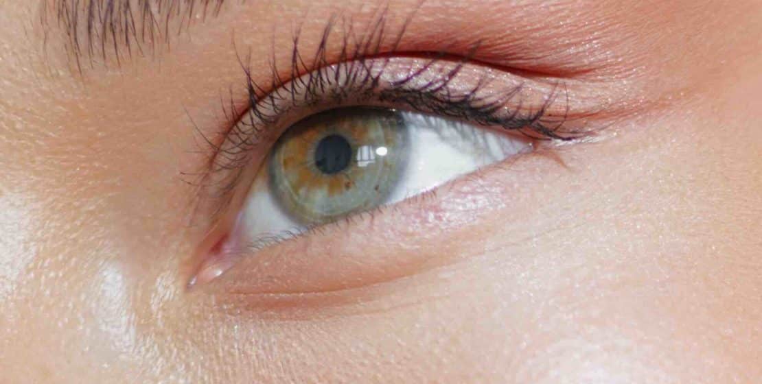 Blepharoplasty