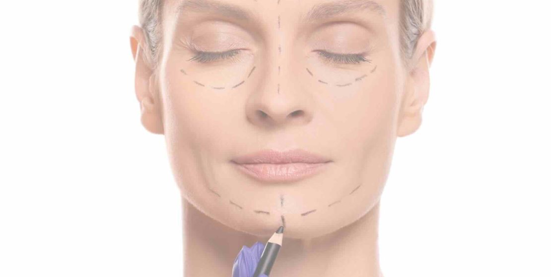 Consultation – Cosmetic surgery