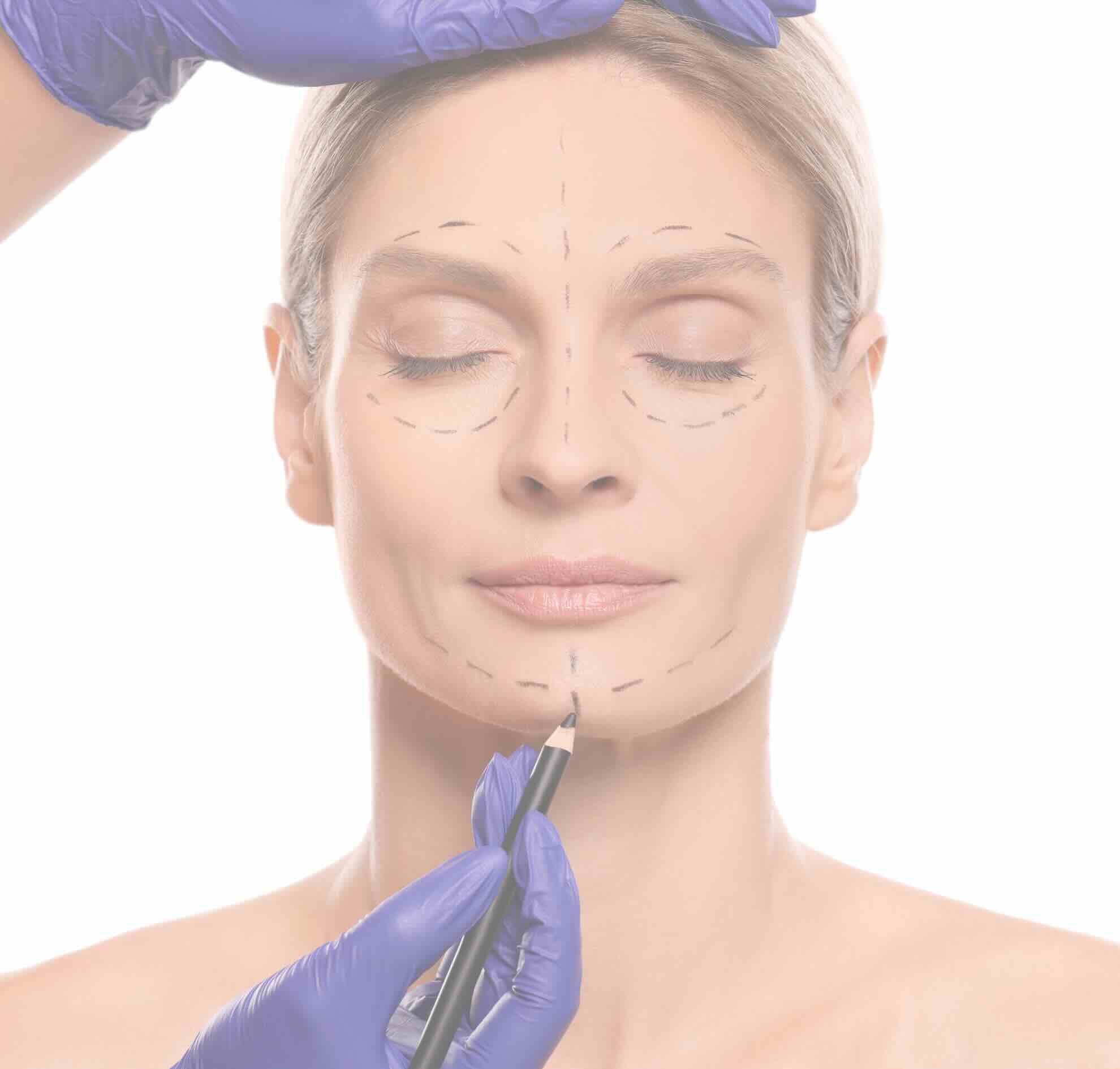 Consultation – Cosmetic surgery