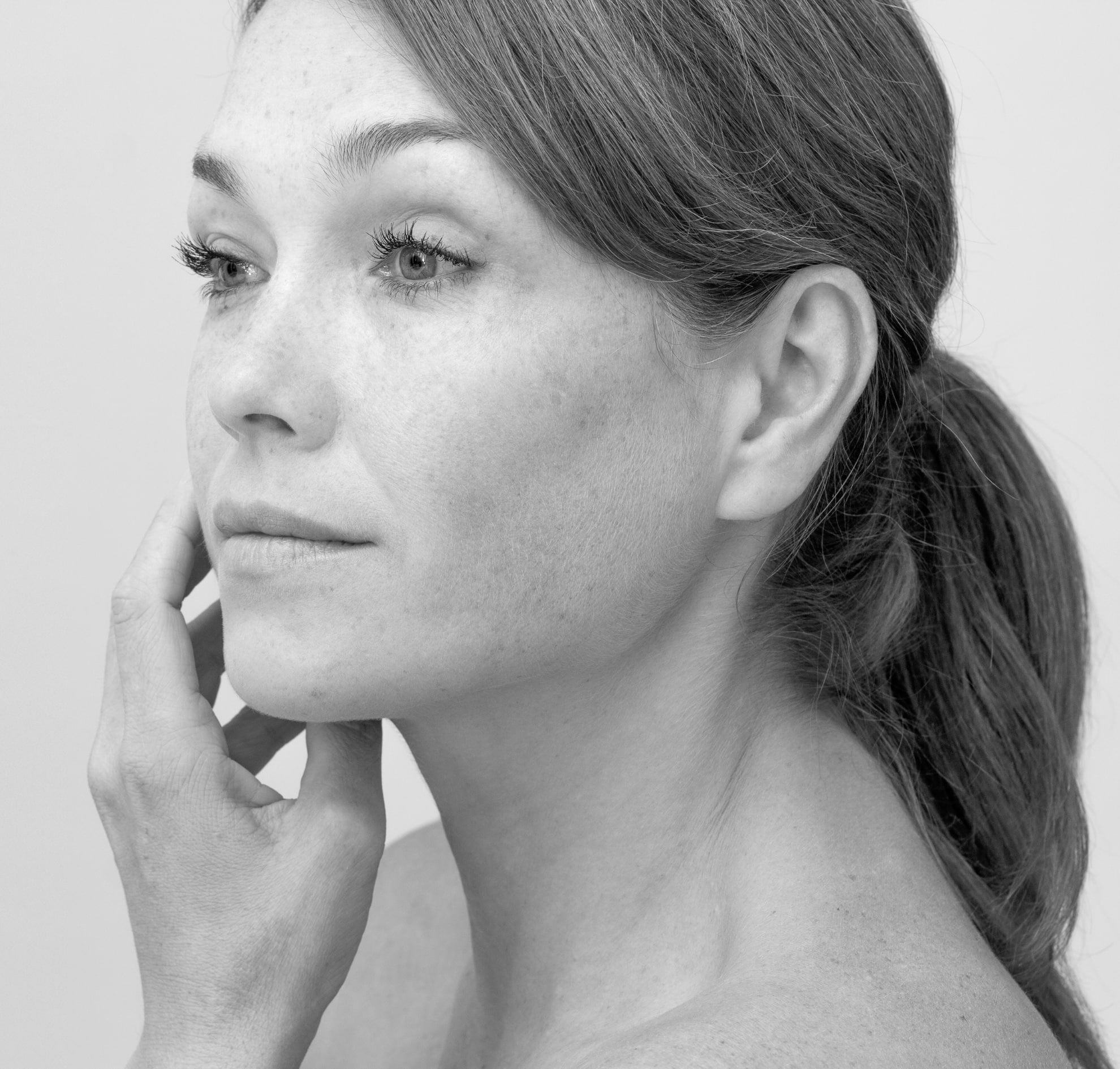Injecting dark circles under the eyes