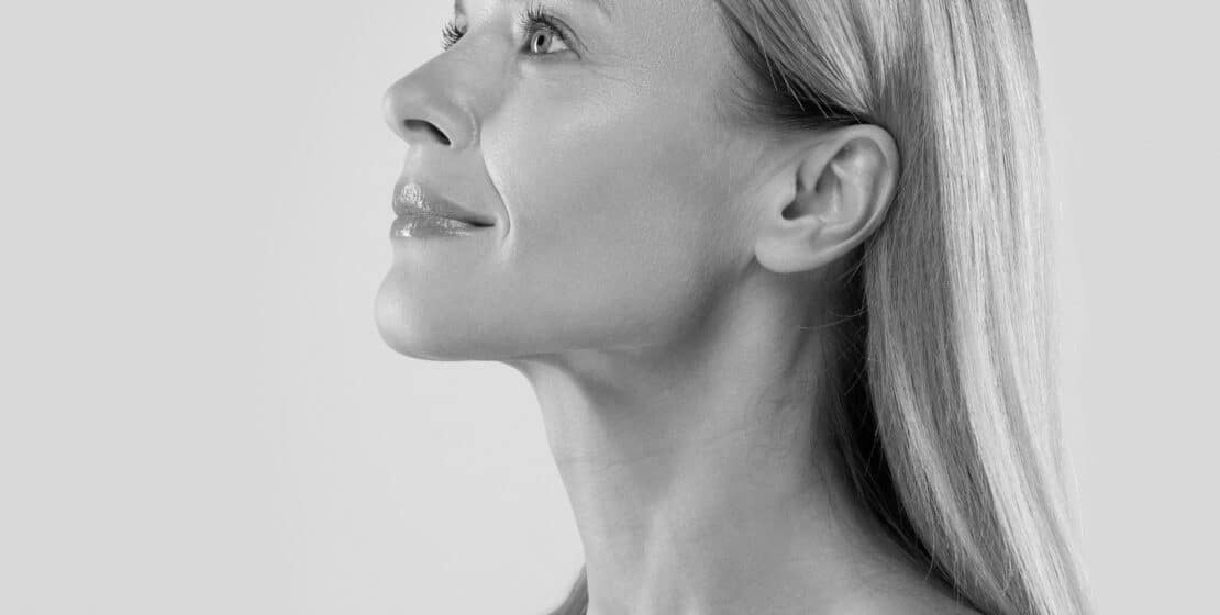 Falten­behandlung (Filler)