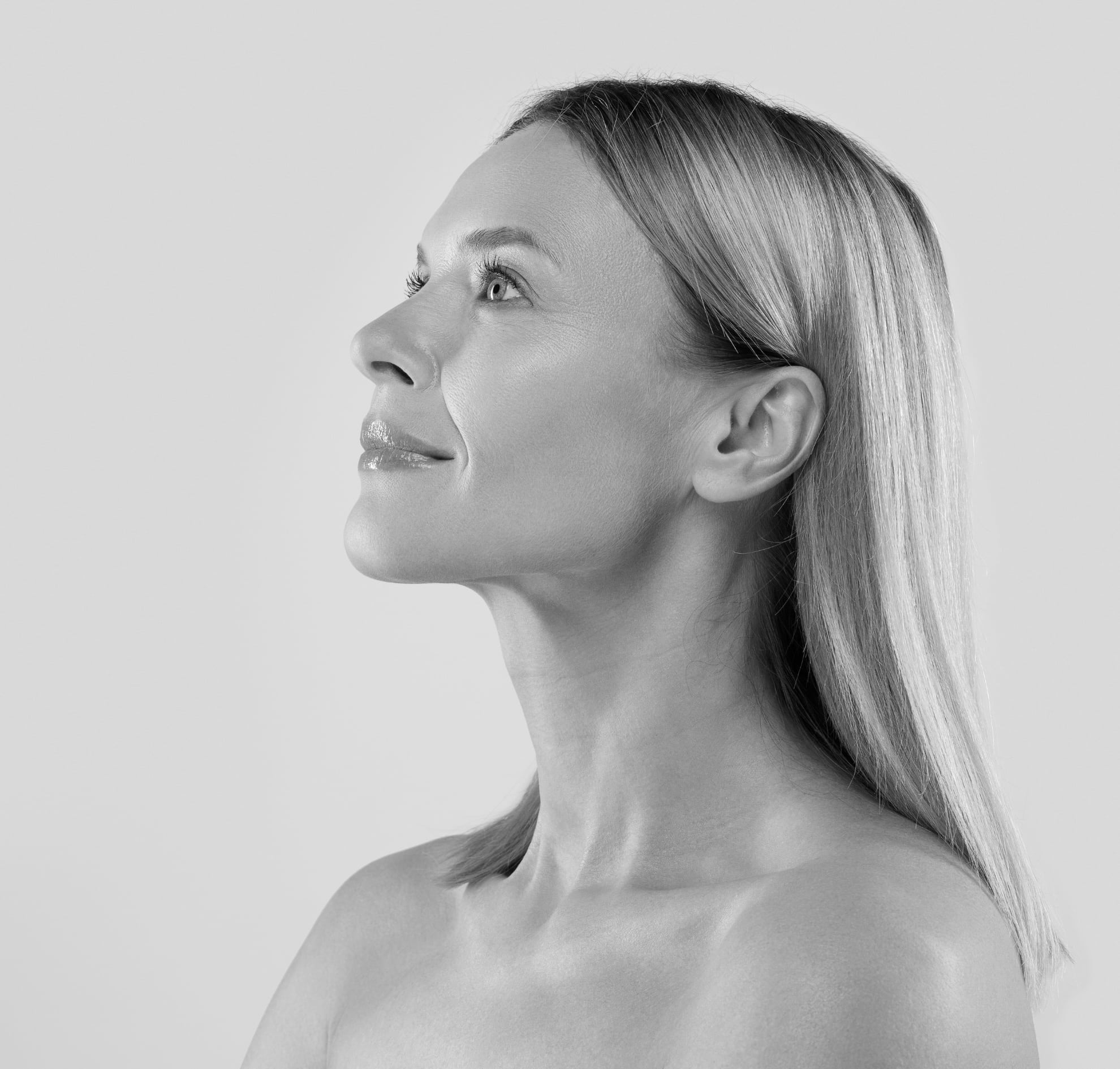 Wrinkle treatment (filler)