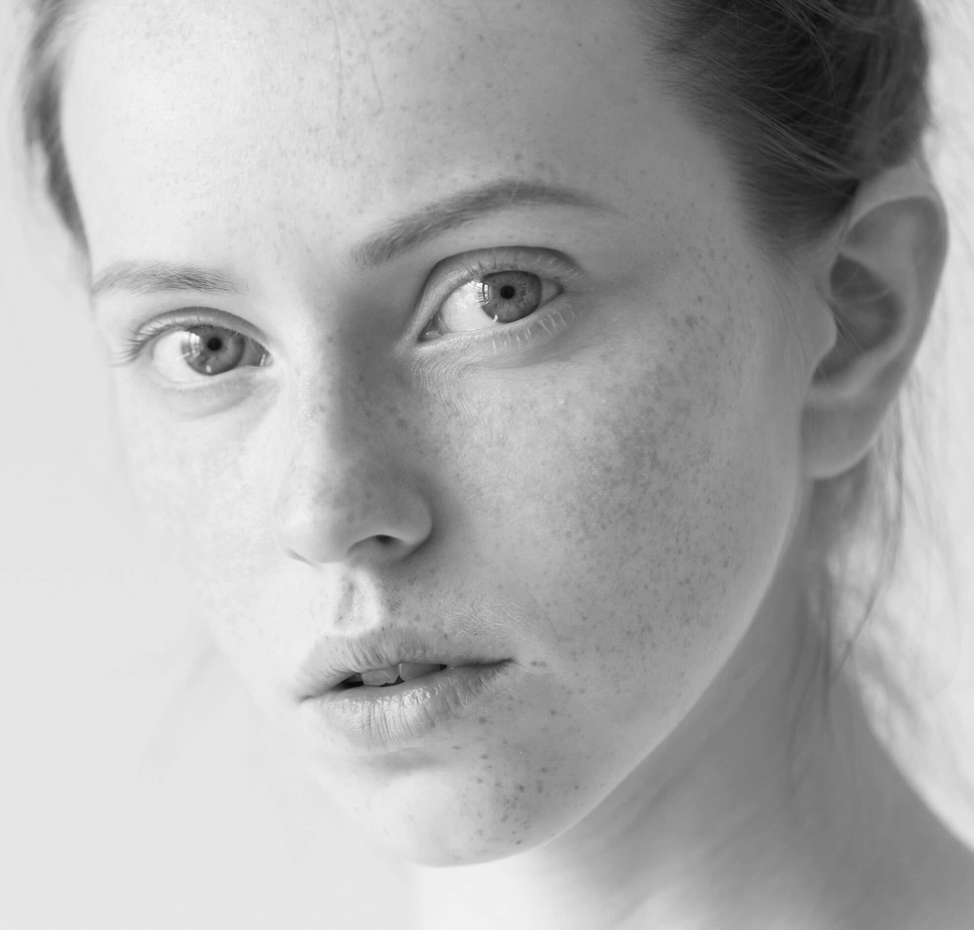 Remove pigment spots